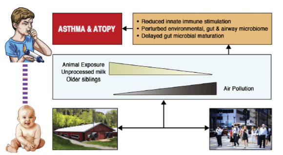 Figure 2 Simplified Association Between Urban vs Rural Built Environment and Likelihood of Asthma and Atopy